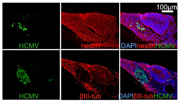 neural-tissue-img